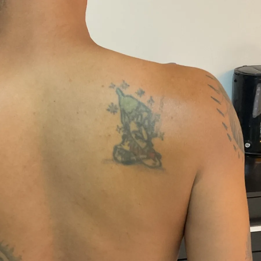 Tatuagem antiga apagada e esverdeada na omoplata, antes da cobertura